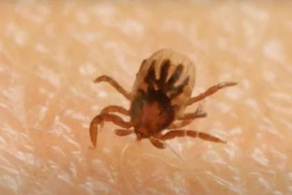 Ezt tegyük, ha beszakad a kullancs feje, így kell helyesen eltávolítani